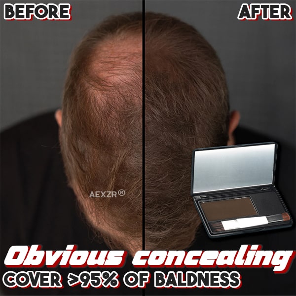 Aexzr® Bald Cover-Up Hair Concealer Powder