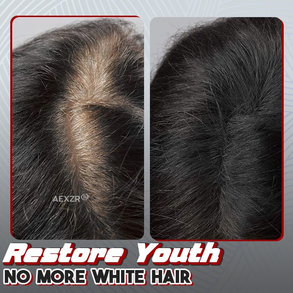 Aexzr® Bald Cover-Up Hair Concealer Powder
