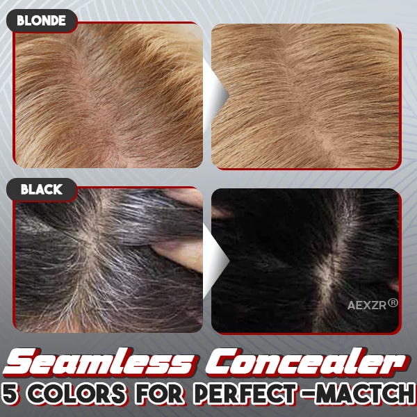 Aexzr® Bald Cover-Up Hair Concealer Powder